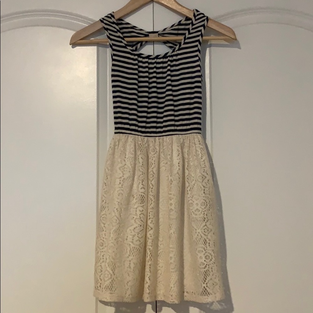 Striped and Lace Dress